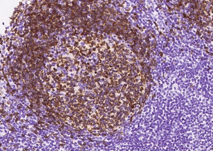Recombinant CD79A/Ig-alpha Monoclonal Antibody - small - 5
