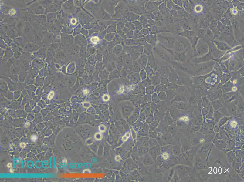 OVCAR-5 Cell Complete Medium - 4