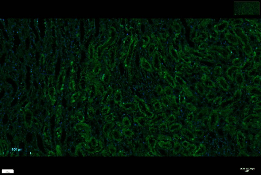 Recombinant NQO1 Monoclonal Antibody - small - 8