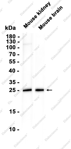 Recombinant Oncostatin M/OSM Monoclonal Antibody - 1
