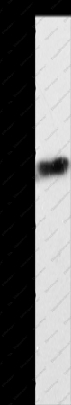 ABCD4 Polyclonal Antibody - 1