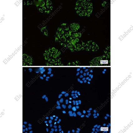 Recombinant Citrate Synthetase Monoclonal Antibody - 2
