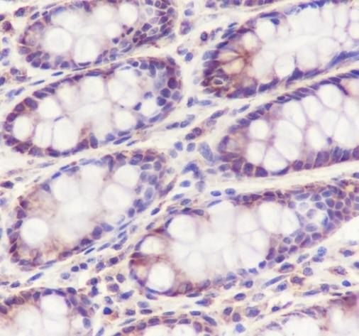 Recombinant Tec Monoclonal Antibody - 2