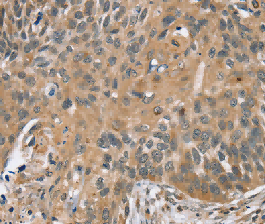 TRIM3 Polyclonal Antibody - 3