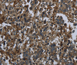 GLUL Polyclonal Antibody - 3