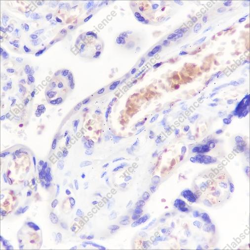 Recombinant Hemoglobin alpha Monoclonal Antibody - 2