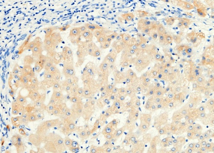 RBP4 Monoclonal Antibody - small - 2