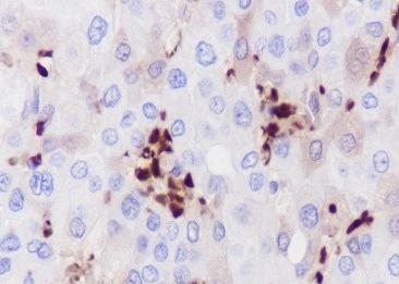 Recombinant Hemoglobin Alpha Monoclonal Antibody-searchlist-1