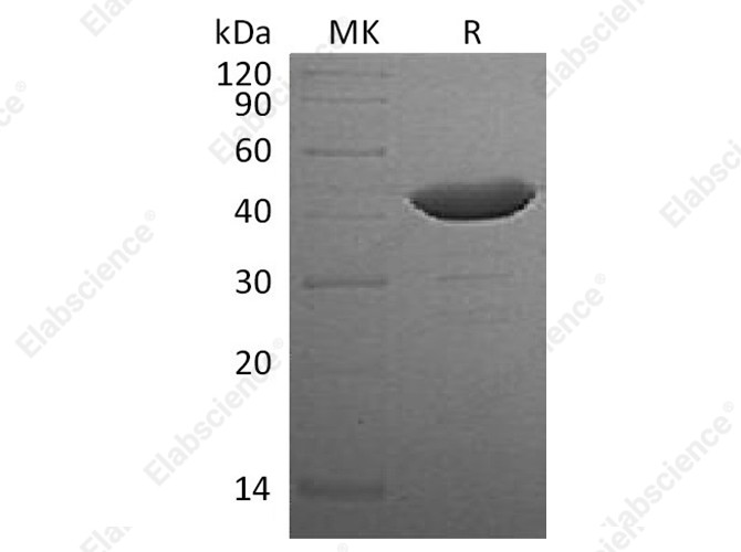 Recombinant Human IDO1/IDO Protein (His Tag) - 1