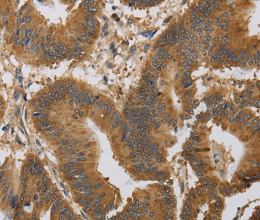 KCNMB4 Polyclonal Antibody - 2