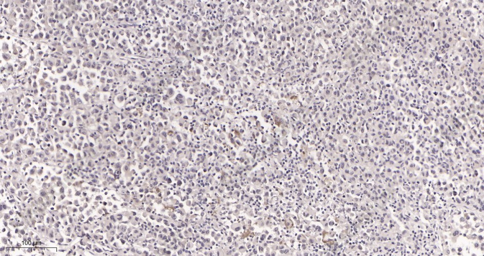 Recombinant MiTF Monoclonal Antibody - 2