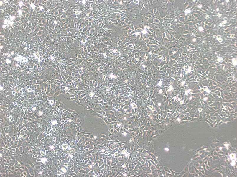 KYSE-140 Cell Complete MediumKYSE-140 Cell Complete Medium - 3
