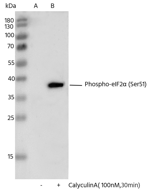 Recombinant Phospho-eIF2α (Ser51) Monoclonal Antibody - small - 3