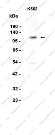 Recombinant HIRA Monoclonal Antibody - 1