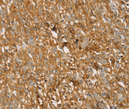 TMPRSS11F Polyclonal Antibody - 3