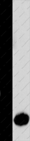 Claudin 7 Polyclonal Antibody - 1