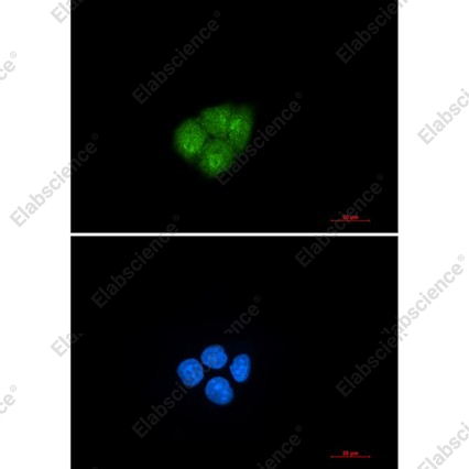 Recombinant Smad2 Monoclonal Antibody - 3