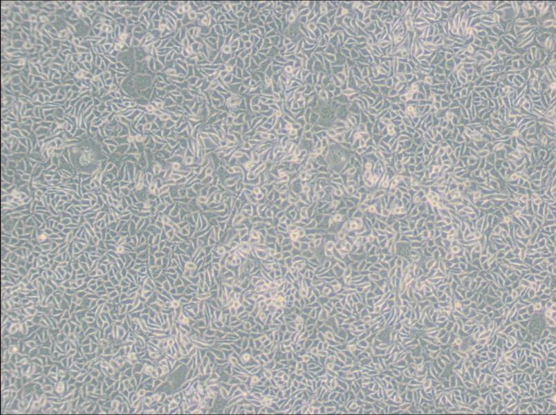 B82 Cell Complete Medium - 2