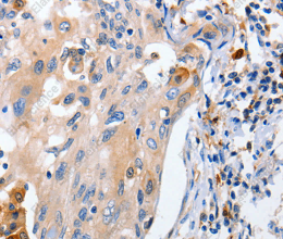 IL18 Polyclonal Antibody - 3