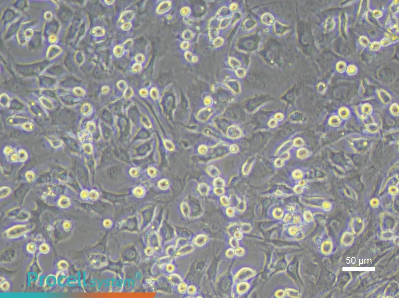 Mouse Intervertebral Disc Annulus Fibrosus Cell Complete Medium - 6