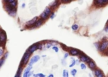 Recombinant CGA/hCG alpha Monoclonal Antibody-searchlist-2