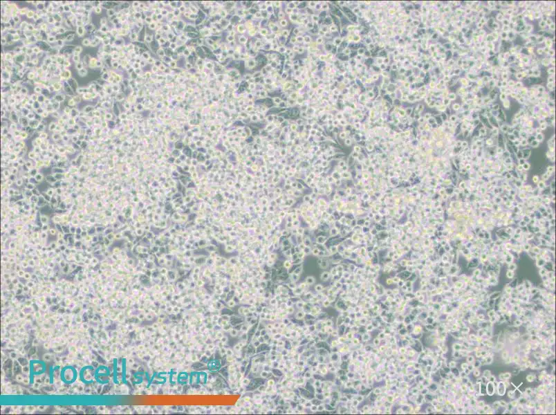 MIA PaCa-2 Cell Complete Medium - 3