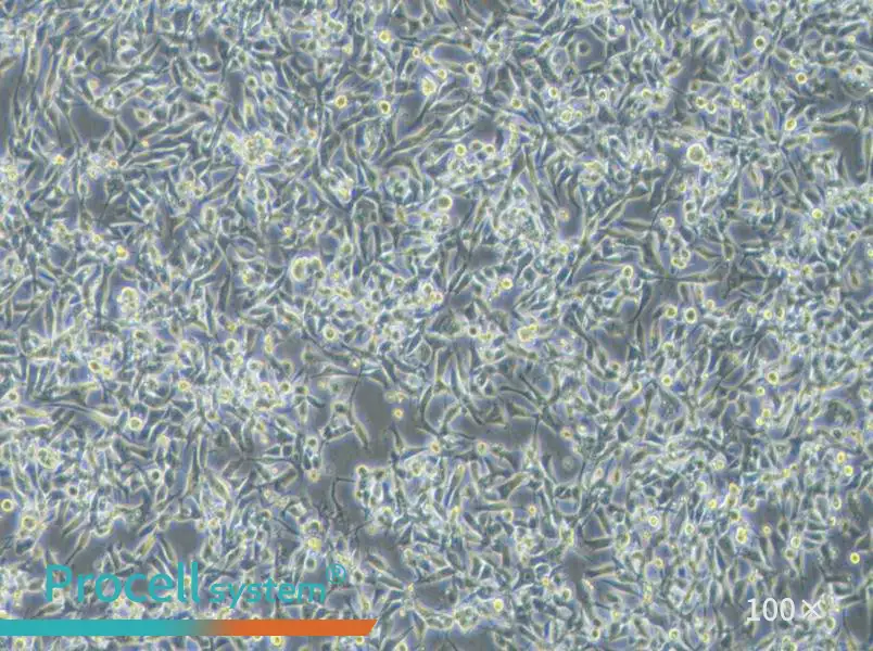 EBC-1 Cell Complete Medium - 1