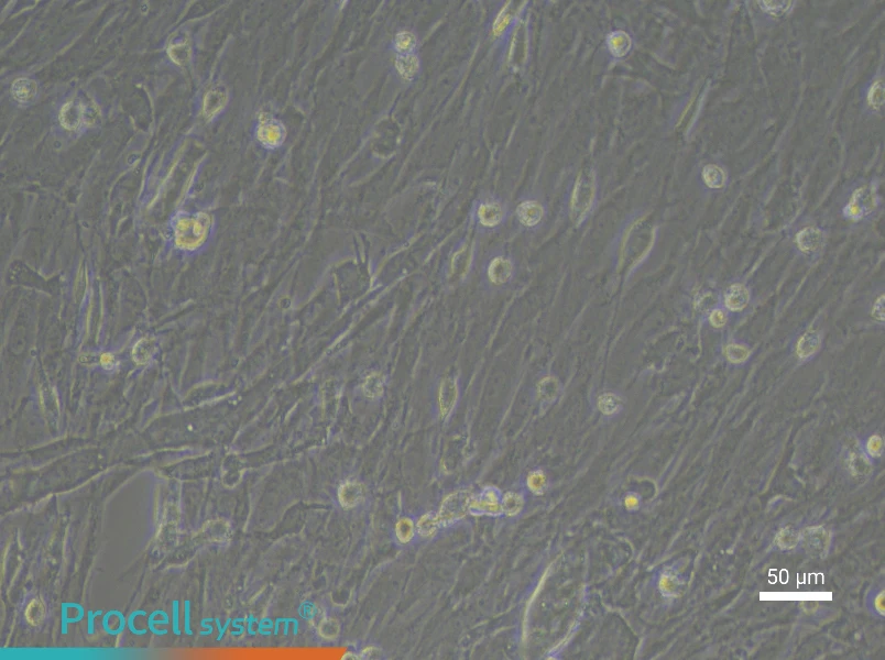 Rat Pancreatic Stellate Cell Complete Medium - 5