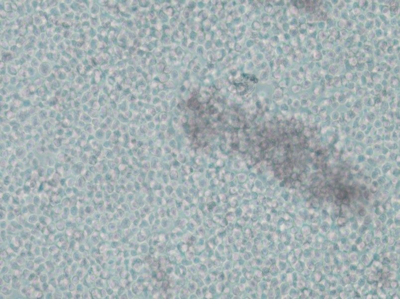 IM-9 Cell Complete Medium - small - 5
