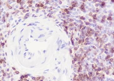 Recombinant CD7 Monoclonal Antibody-searchlist-2