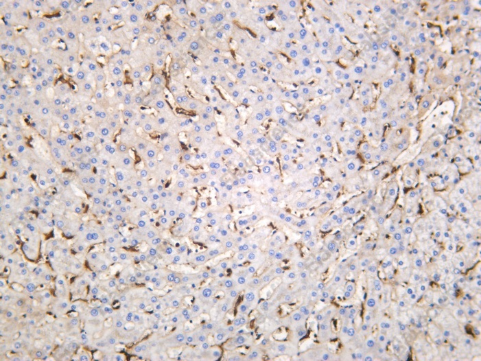 Recombinant ACADL Monoclonal Antibody - 1