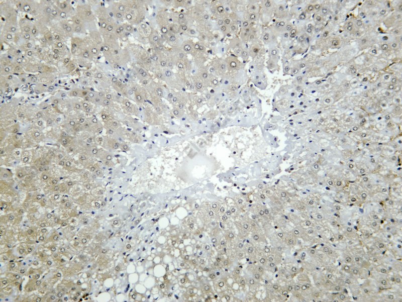 Recombinant HGF Monoclonal Antibody - 2