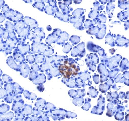 Recombinant IRAK1 Monoclonal Antibody - small - 3