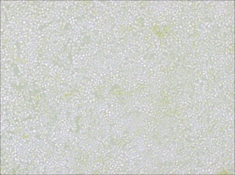 OKT 11 Cell Complete Medium - small - 2