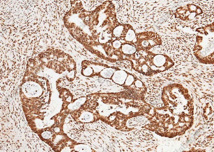 CCNE1/Cyclin-E1 Monoclonal Antibody - 3