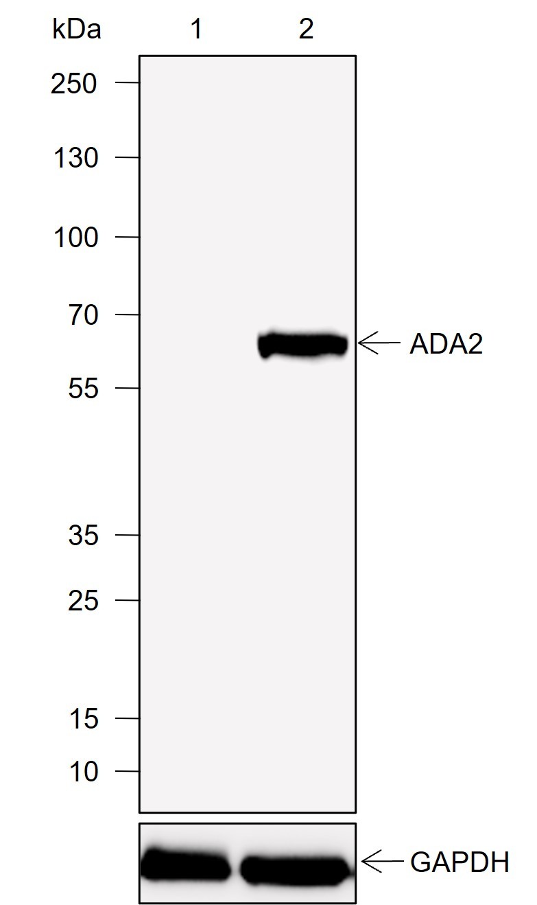 Recombinant ADA2 Monoclonal Antibody-searchlist-1