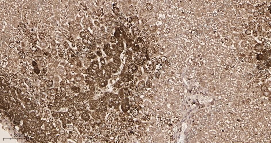 Recombinant Glutamine Synthetase Monoclonal Antibody - 3