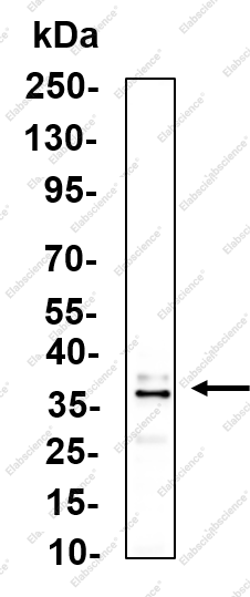 Recombinant TOMM40 Monoclonal Antibody - 2
