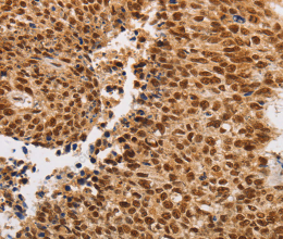 THOC7 Polyclonal Antibody - 3