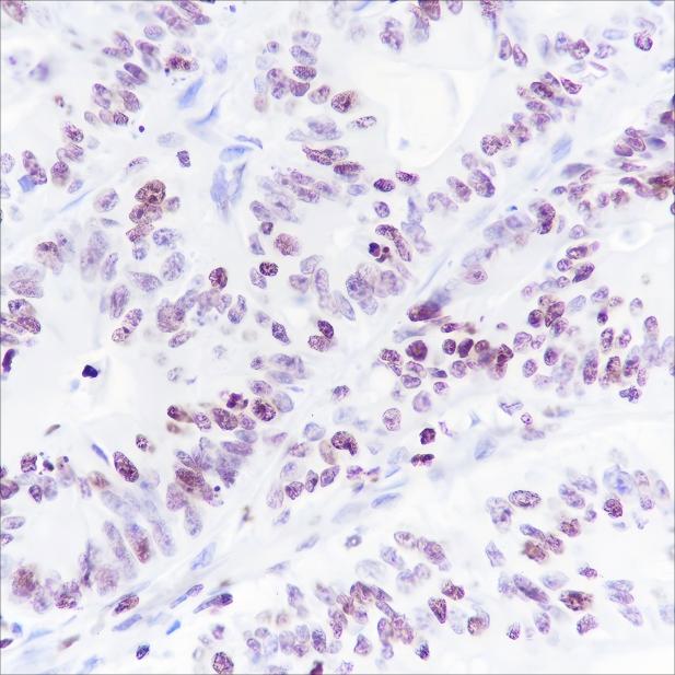 Recombinant Histone H1 (CT) Monoclonal Antibody - 3