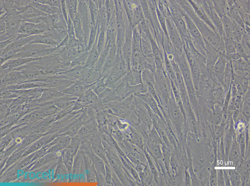 Human Esophageal Fibroblast Complete Medium - 4