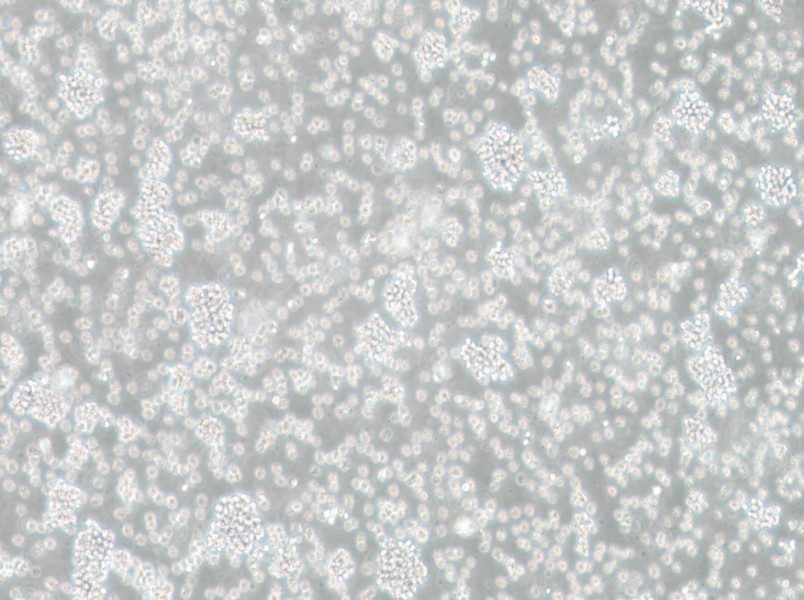 SU-DHL-6 Cell Complete Medium - 3