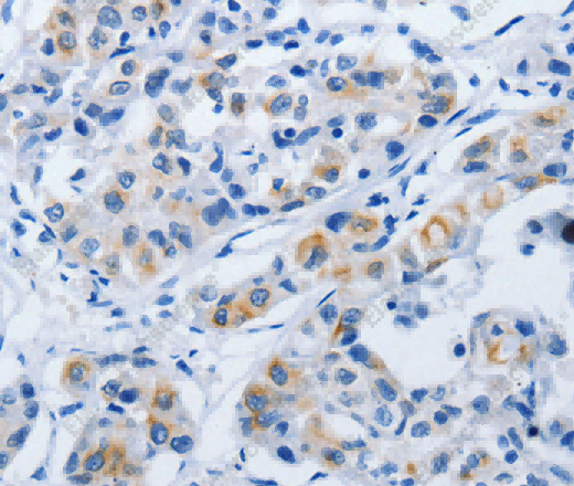 BPIFB3 Polyclonal Antibody - 3