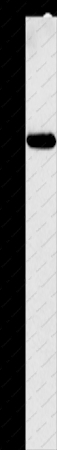 CALCRL Polyclonal Antibody - 1