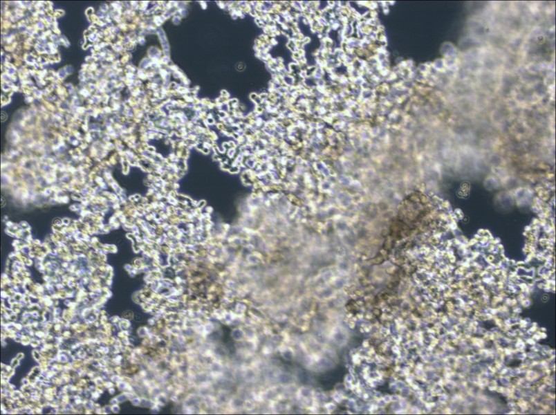 NCI-H526 Cell Complete Medium - 3