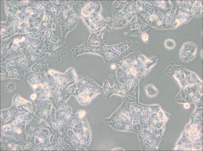MDA-MB-175VII (DMEM) Cell Complete Medium - 6