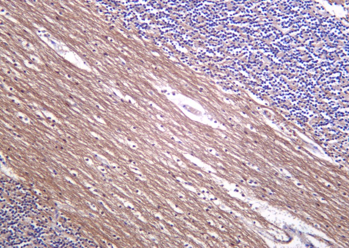 Recombinant Neurofilament (NF-L) Monoclonal Antibody-searchlist-1