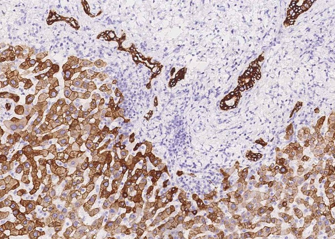 Cytokeratin 8 Monoclonal Antibody-searchlist-1