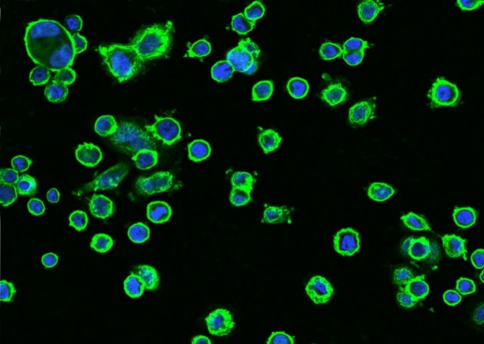 Recombinant HER2/ErbB2/CD340 Monoclonal Antibody - small - 2