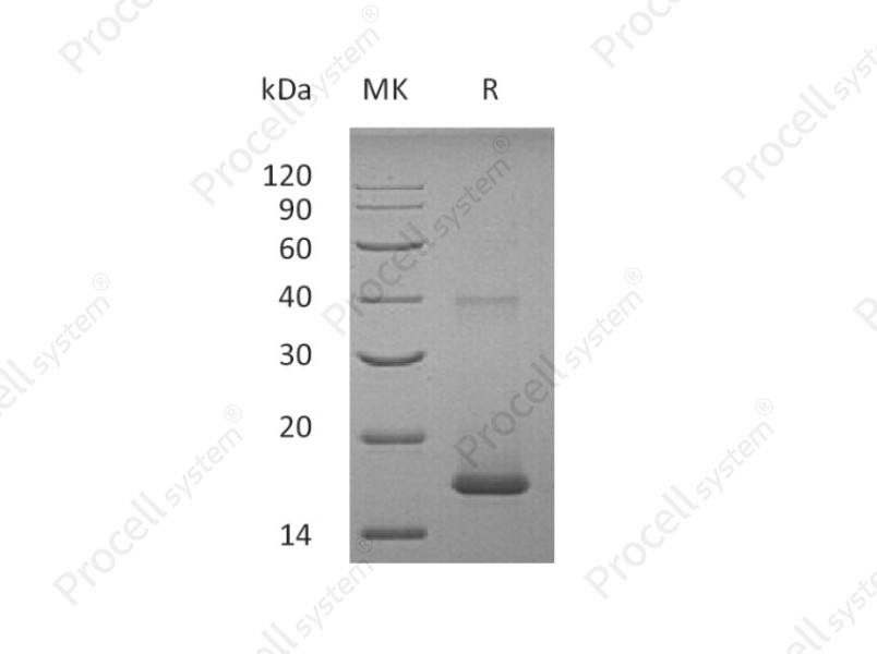 IL-38/IL-1F10/IL-1HY2, Human, Recombinant